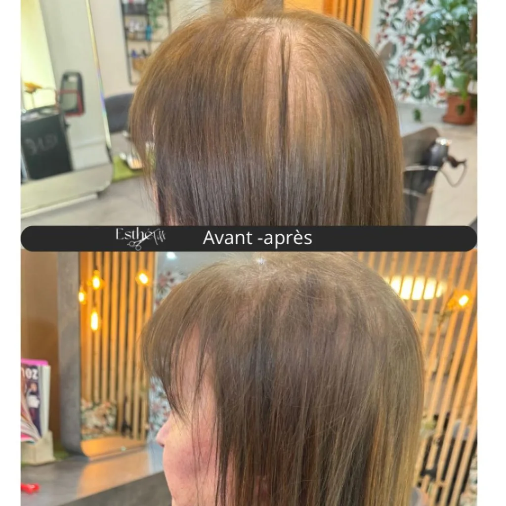 Avant et après sur une chevelure claire vue du dessus, raie moins visible